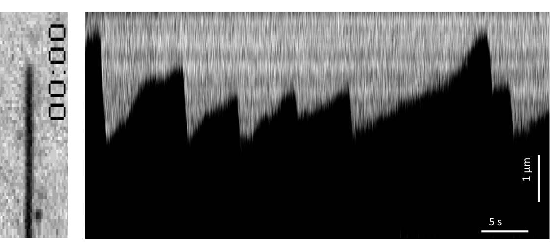 Microtubule Kymograph using Label free IRM